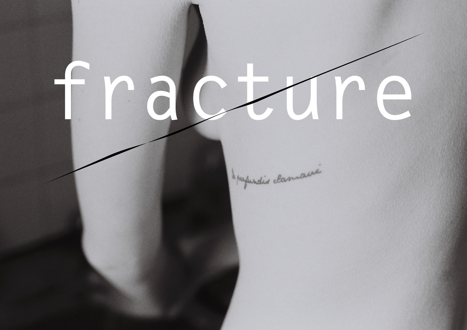 Fracture